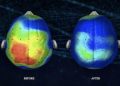 Neuroscientists Discover A Song That Can Reduce Anxiety By 65 Percent (Listen)